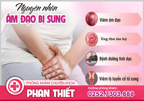 Sưng âm đạo là bệnh gì?