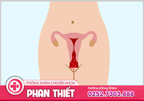 Âm đạo ra máu khi quan hệ có thể từ bệnh phụ khoa nguy hiểm