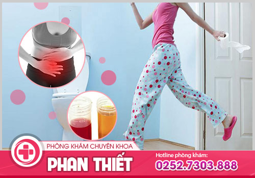 đi tiểu nhiều lần trong ngày