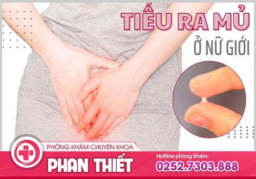 Tiểu mủ ở nữ và nam giới cảnh báo mắc bệnh lý nguy hiểm