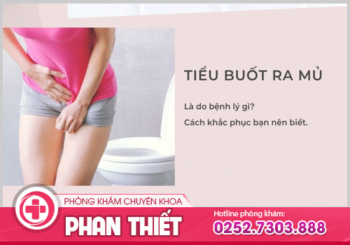 Tiểu mủ ở nữ và nam giới cảnh báo mắc bệnh lý nguy hiểm