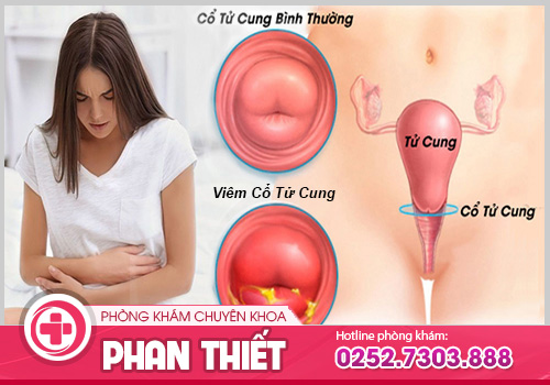 Điểm danh những bệnh phụ khoa thường gặp