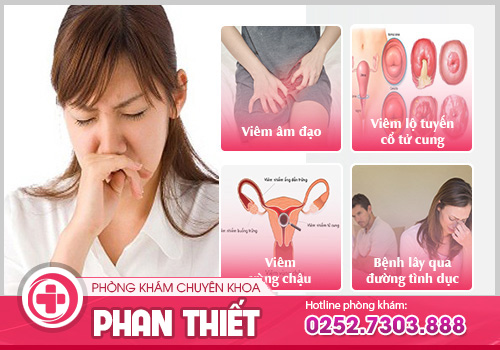 Vùng kín có mùi - Nỗi ám ảnh của nhiều chị em