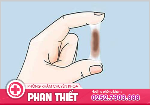 Yếu tố nào gây nên khí hư màu nâu ở nữ giới?